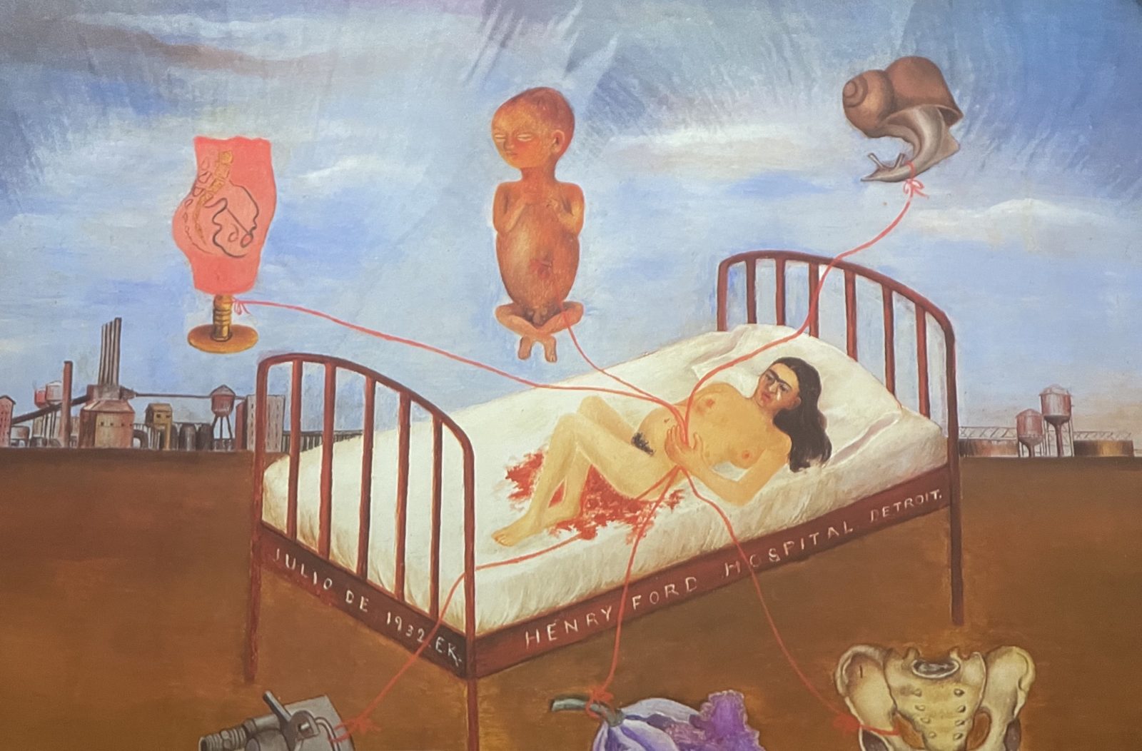 Viva Frida Kahlo  Lausanne Fausse couche et hospitalisation à Detroit